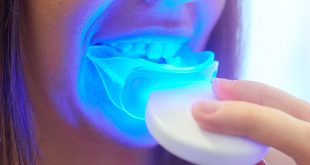 سفید کردن دندان با لیزر
