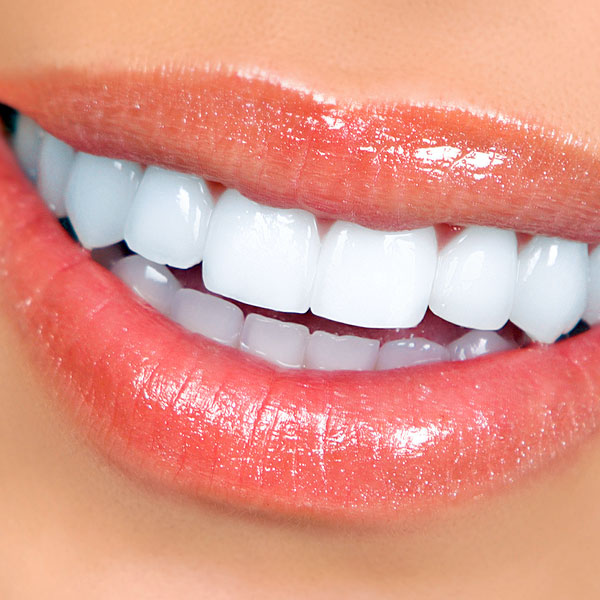دندانپزشکی زیبایی چیست؟ انواع خدمات دندانپزشکی زیبایی چیست؟