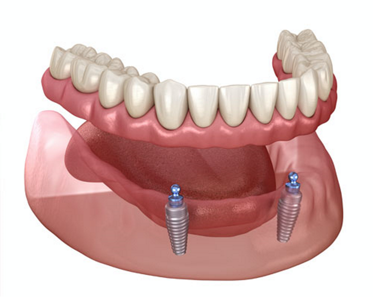 آشنایی با تخصص های دندانپزشکی | پردرآمدترین تخصص های دندانپزشکی