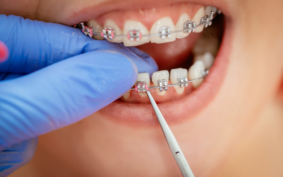 ارتودنسی یکی از تخصص های رشته دنداننپزشکی