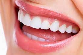  راه های سفید کردن دندان