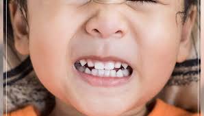 دندان قروچه چه تاثیری بر دندان ها می گذارد؟ | علت دندان قروچه چیست؟