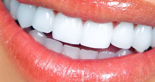 دندانپزشکی زیبایی چیست؟ انواع خدمات دندانپزشکی زیبایی چیست؟