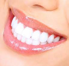 چگونه می توانیم دندان های سفیدی داشته باشیم؟