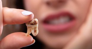 روش های جلوگیری از پوسیدگی دندان