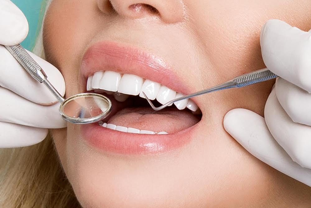 انواع روکش دندان کدامند؟ قیمت روکش دندان | کلینیک تخصصی ژنیک