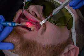 درمان ریشه دندان و عصب کشی با لیزر چگونه است؟ | کلینیک ژنیک