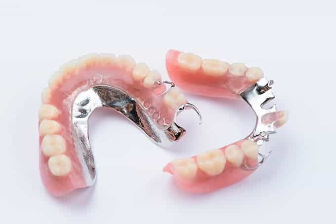 انواع پروتز دندان و قیمت آن | قیمت دندان پروتز متحرک وثایت - ژنیک