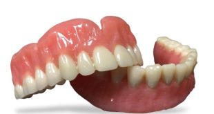 انواع پروتز دندان و قیمت آن