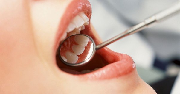 آینه دندانپزشکی و کاربرد آن | قیمت آینه دندانپزشکی | کلینیک ژنیک