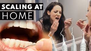 روش جرم گیری دندان در منزل | از بین بردن جرم دندان در منزل - ژنیک