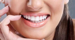 انواع روش های سفید کردن دندان | سریعترین زمان سفید کردن دندان - ژنیک