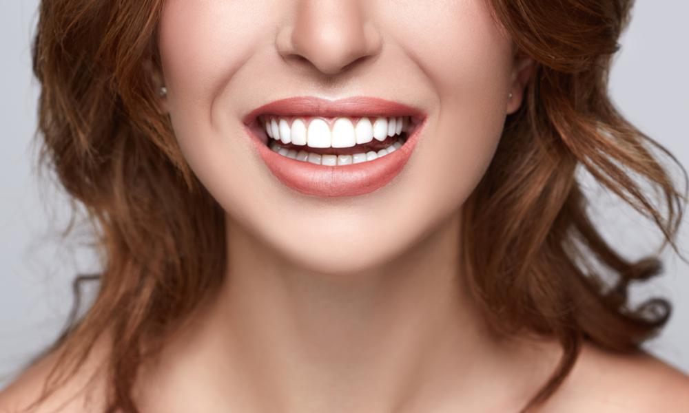 تاثیر روکش دندان بر زیبایی | روکش دندان برای زیبایی - ژنیک