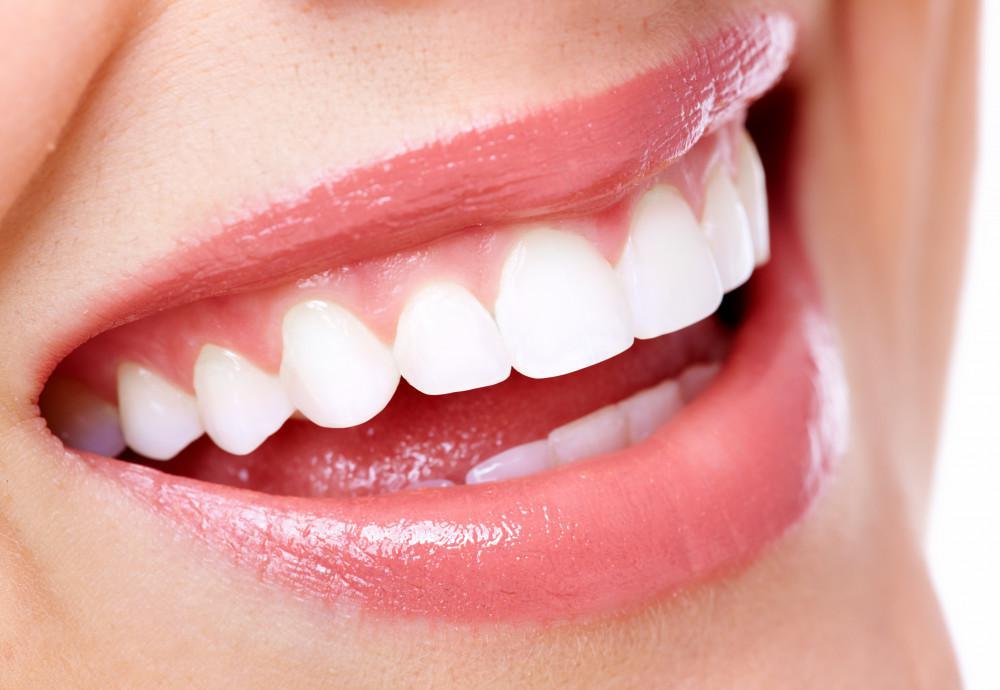 تاثیر روکش دندان بر زیبایی | روکش دندان برای زیبایی - ژنیک