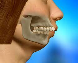 جراحی اختلالات دهان و دندان