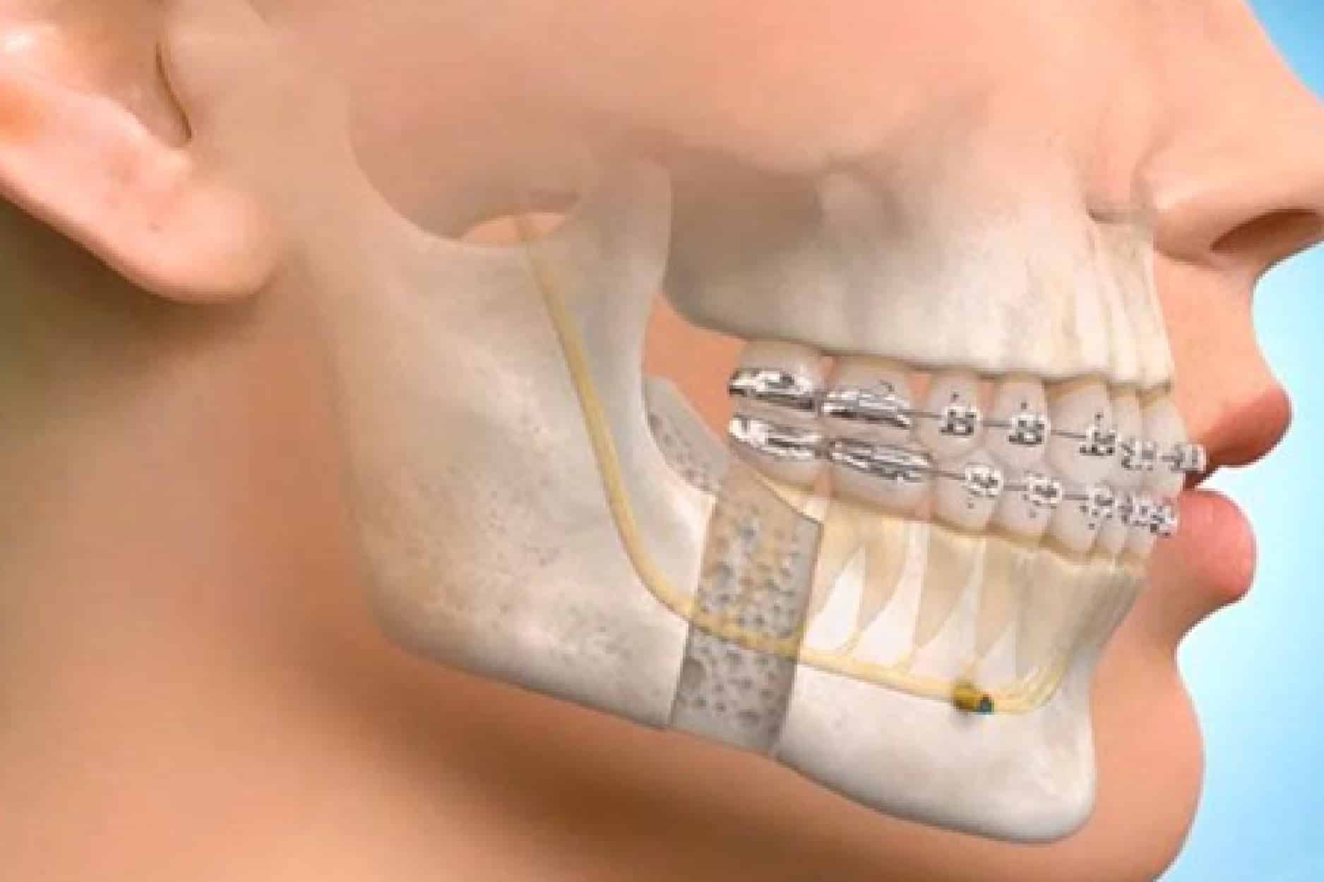جراحی اختلالات دهان و دندان