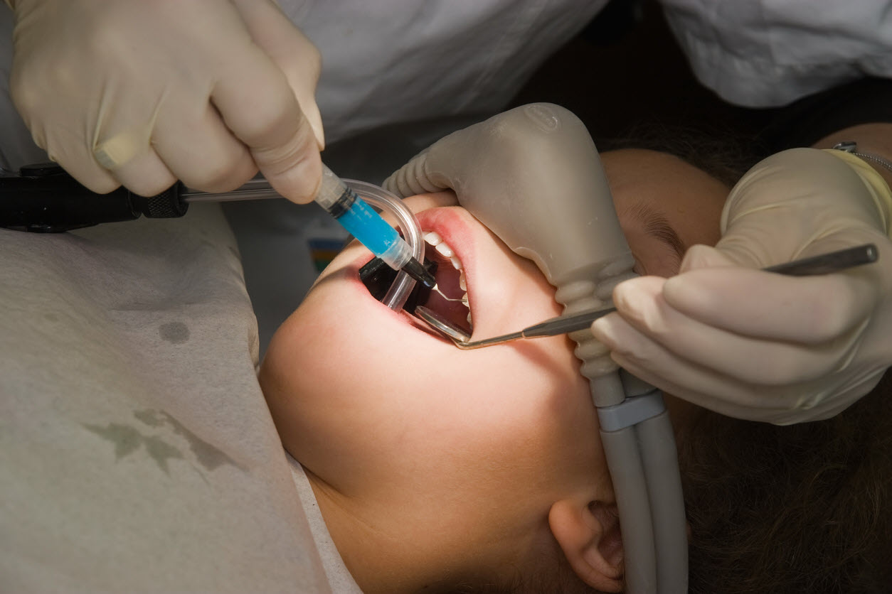 دندانپزشکی کودکان، با بی هوشی یا بدون بیهوشی