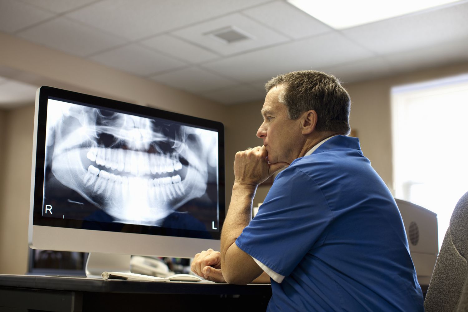 نقش رادیوگرافی در عصب کشی دندان