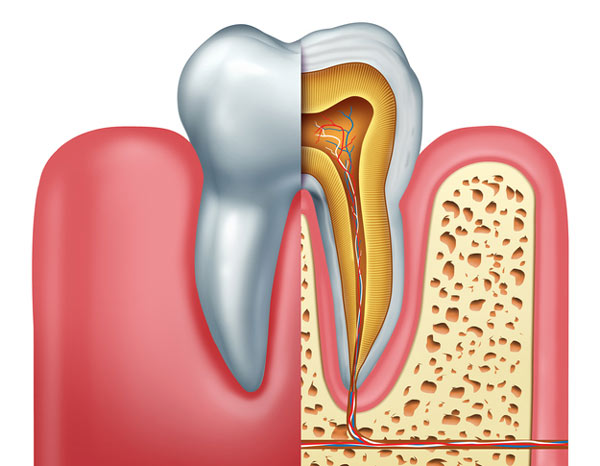 درمان ریشه دندان با روش های نوین 