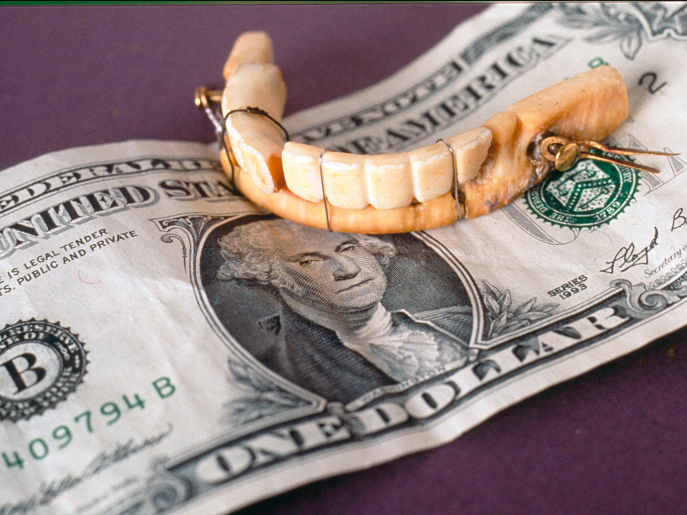 هزینه دست دندان مصنوعی کامل