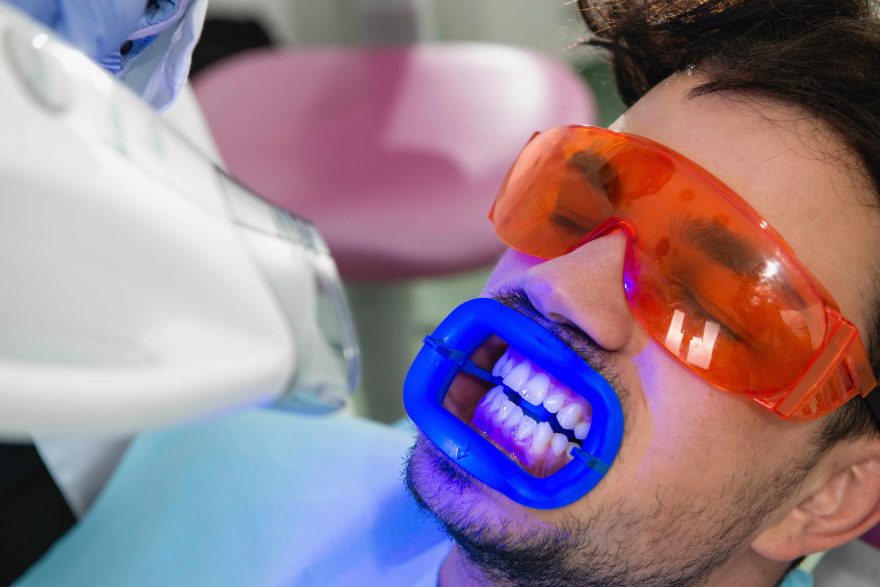 بهترین مرکز تخصصی بلیچینگ دندان