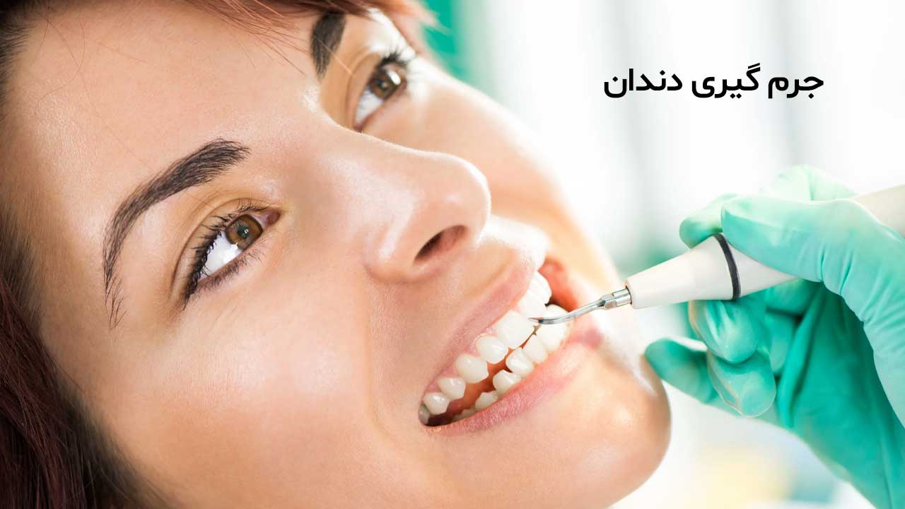 بهترین مرکز جرمگیری دندان در تهران