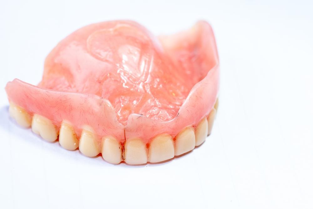 طول عمر دندان مصنوعی