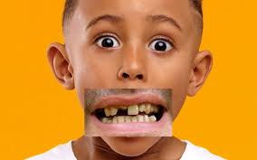 بهترین دندان مصنوعی برای جوانان