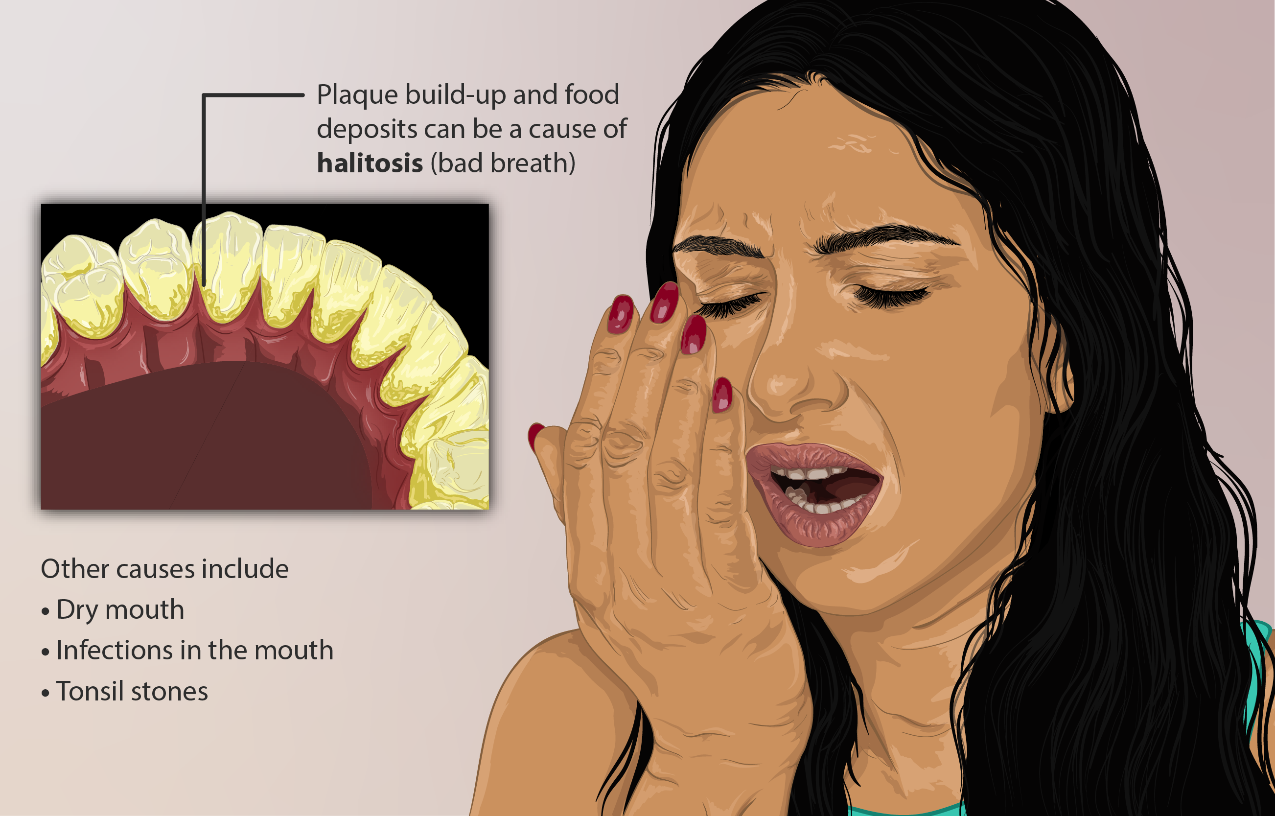 پوسیدگی دندان و بوی بد دهان