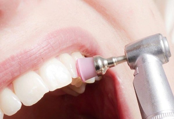 بروساژ دندان