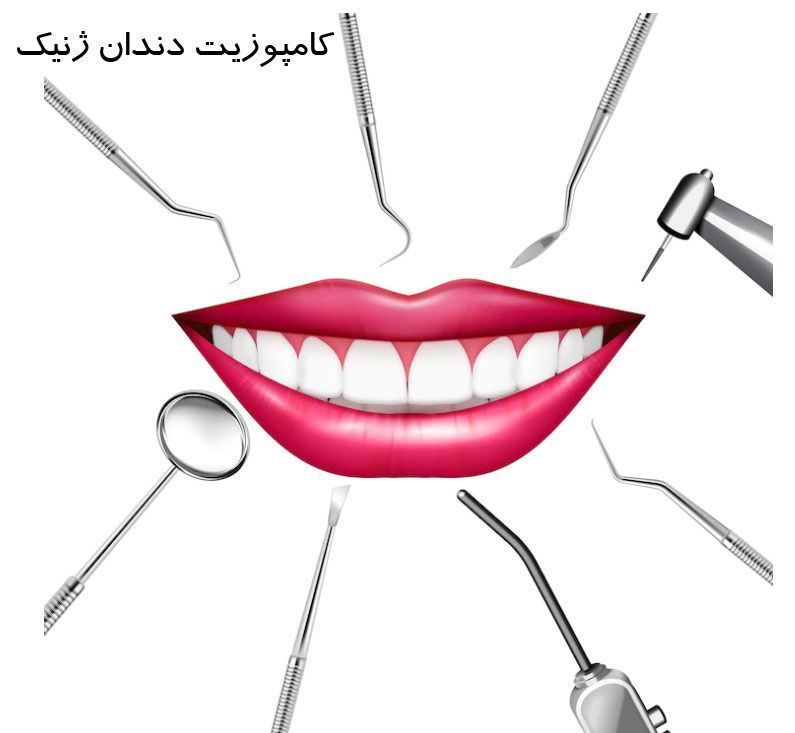 کامپوزیت-دندان ژنیک