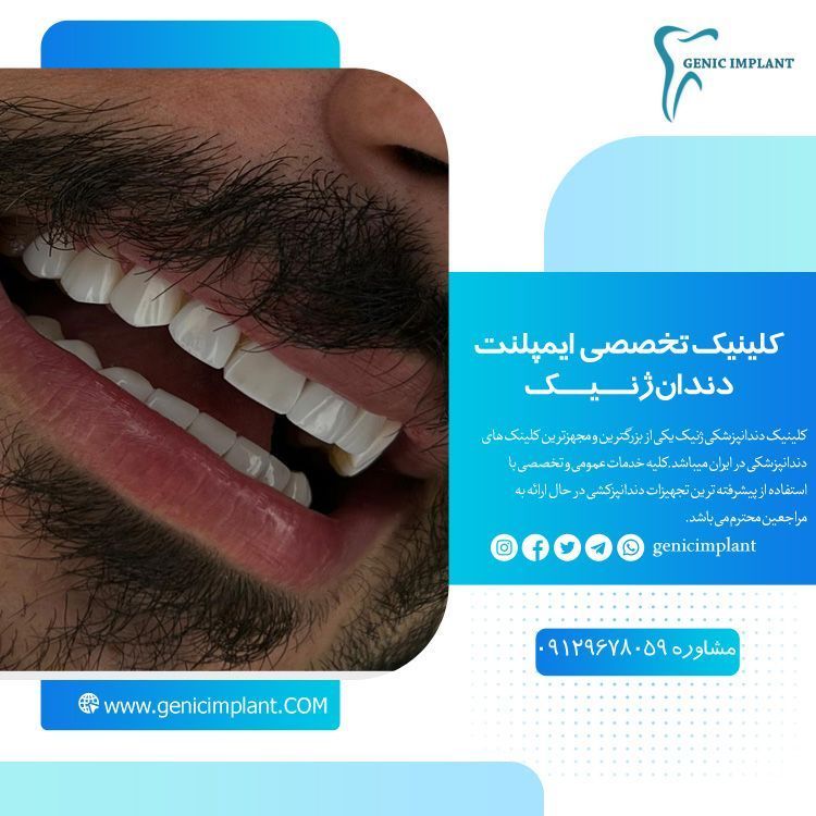 ایمپلنت دندان تهران