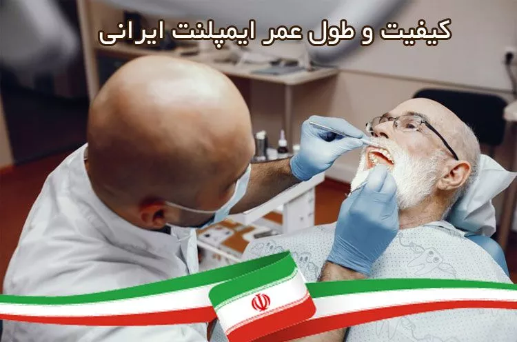طول عمر ایمپلنت ایران